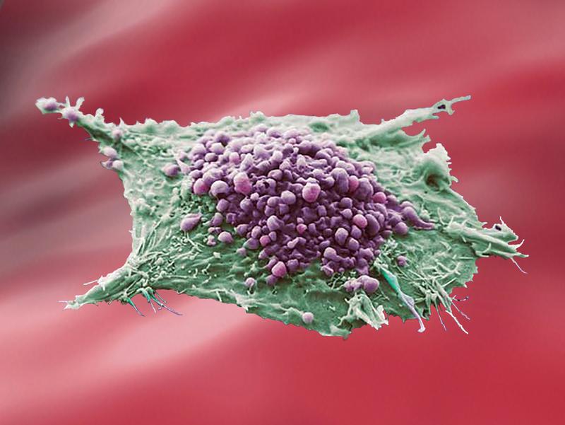 Cancer Cell